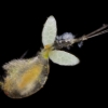 Ciliate colony on body of a freshwater copepod, Herts, England